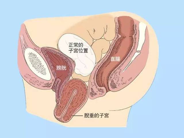 50f26e51c3064b6fb9b18eb8eca61726_th.jpg